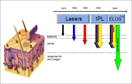 ELOS Technology